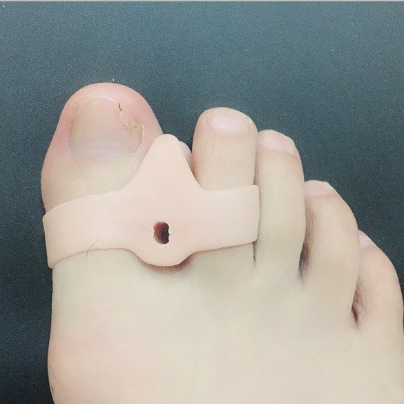 Toe Separator Silicon - Big Toe Bunion Pads Relief Foot