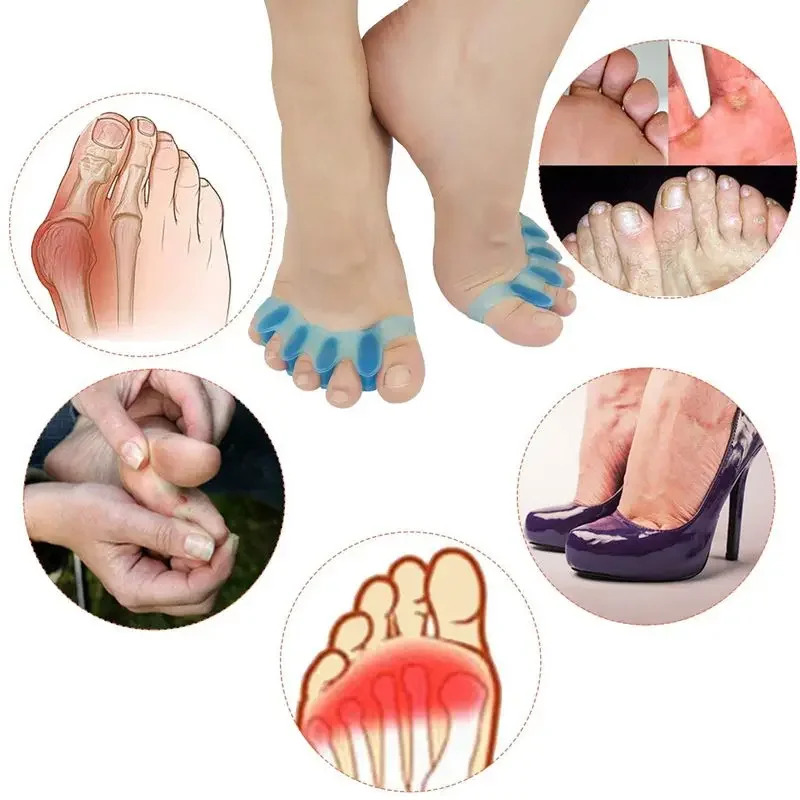 2Pcs=1Pair New Protective Toes - Toe Separator Silicon recension och pris