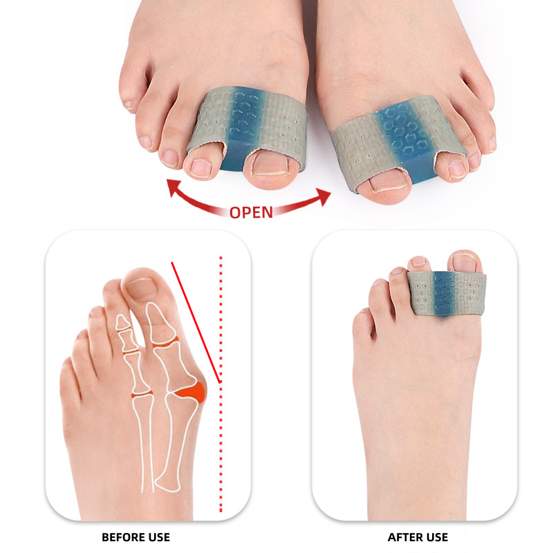 1PCS Gel Hallux Valgus Hammer  - Toe Separator Silicon recension och pris